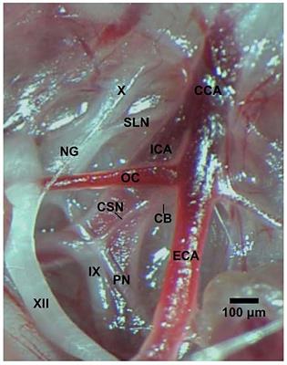 The Role of Carotid Sinus Nerve Input in the Hypoxic-Hypercapnic Ventilatory Response in Juvenile Rats